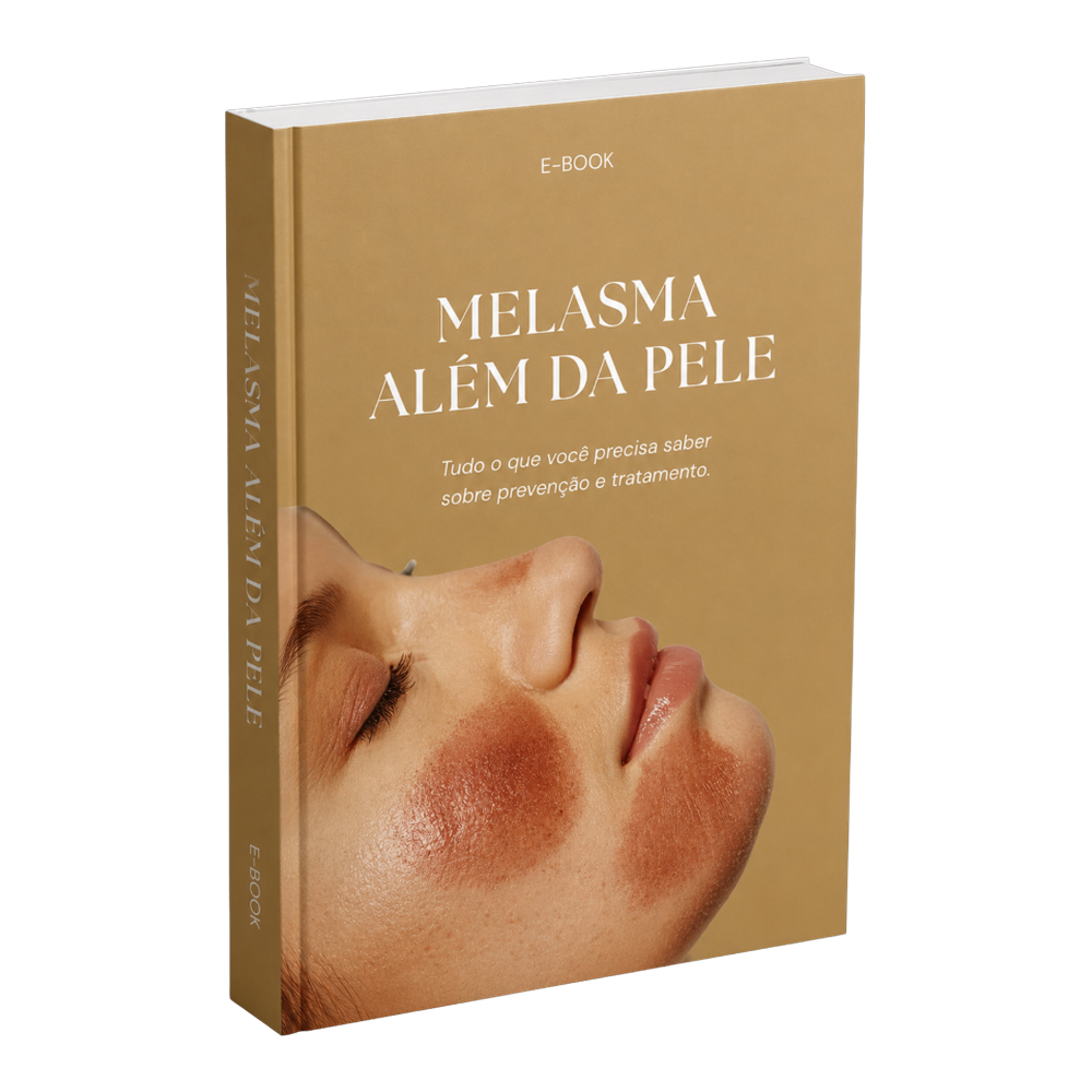 Melasma Além da Pele